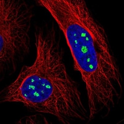 LRRC40 Antibody, Novus Biologicals 25 &mu;L | Buy Online | Novus Biologicals | Fisher Scientific